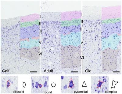 Age-related changes in the primary auditory cortex of newborn, adults and aging bottlenose dolphins (Tursiops truncatus) are located in the upper cortical layers